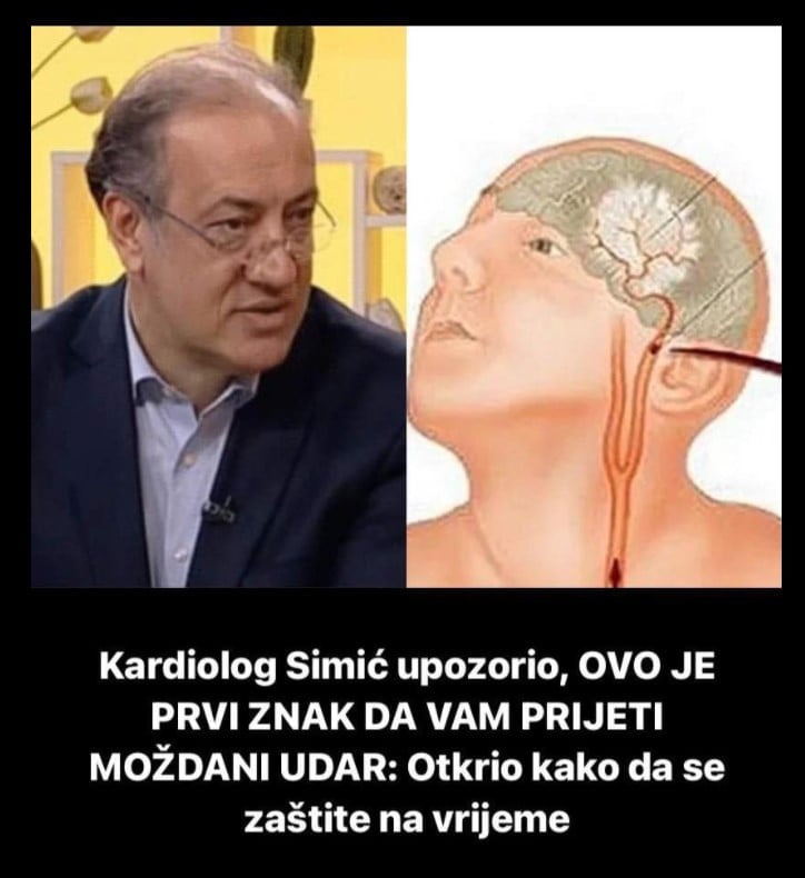 Kardiolog Simić upozorio, OVO JE PRVI ZNAK DA VAM PRIJETI MOŽDANI UDAR: Otkrio kako da se zaštite na vrijeme