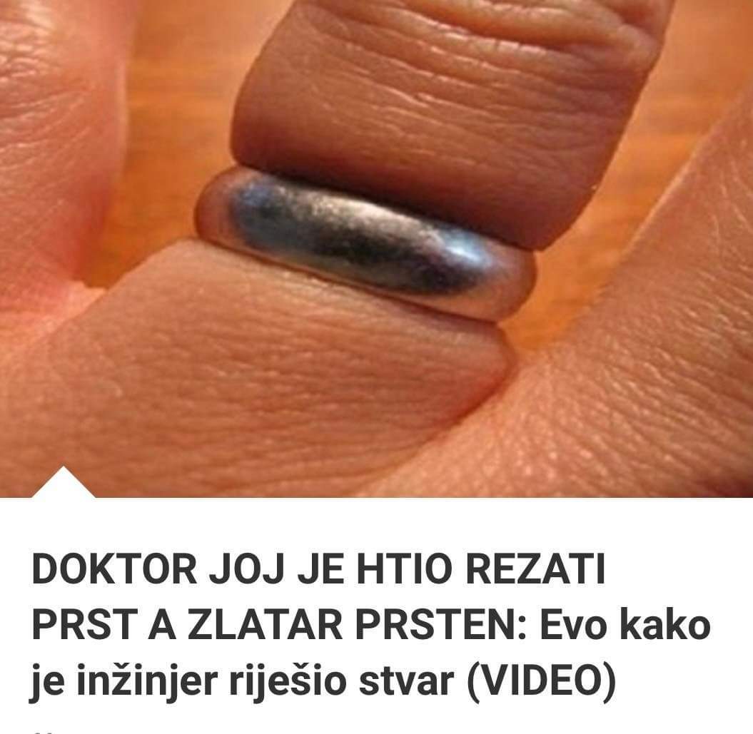 DOKTOR JOJ JE HTIO REZATI PRST A ZLATAR PRSTEN: Evo kako je inžinjer riješio stvar