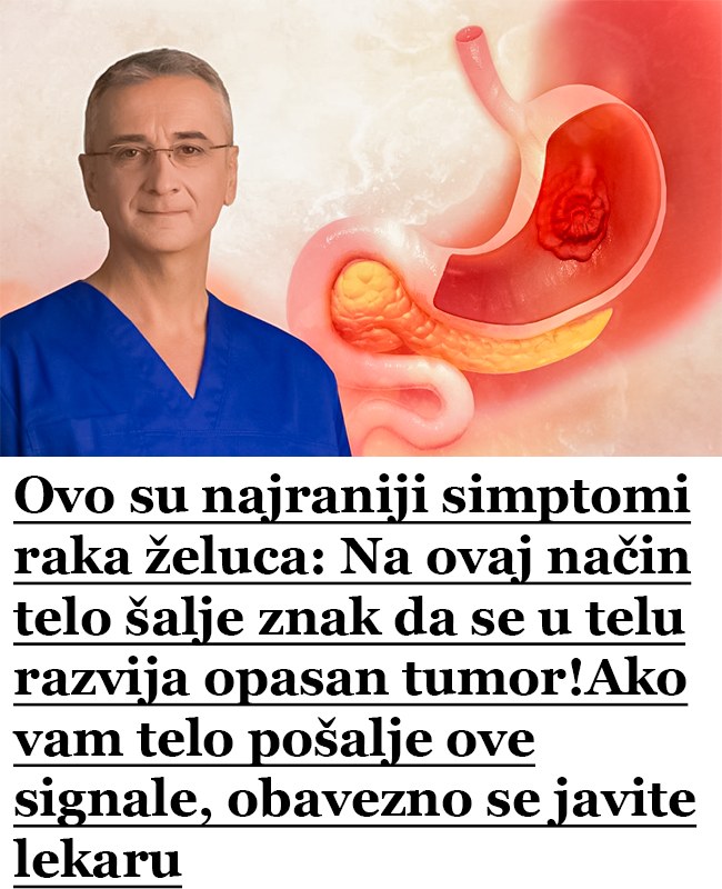 Ovo su najraniji simptomi raka želuca