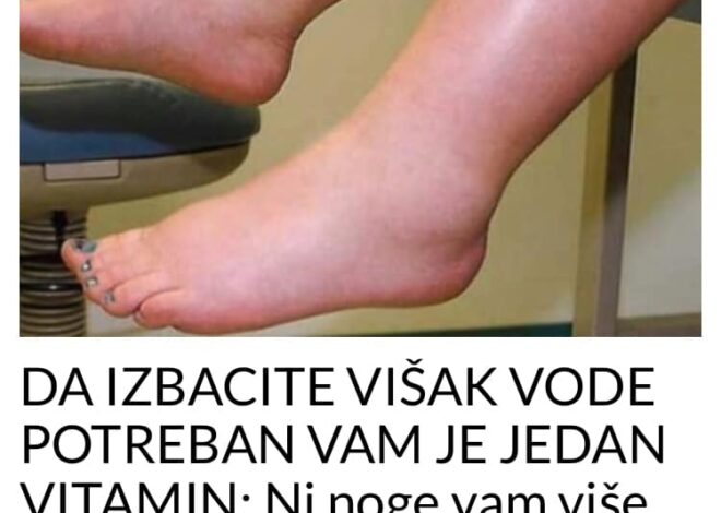 DA IZBACITE VIŠAK VODE POTREBAN VAM JE JEDAN VITAMIN: Ni noge vam više neće oticati, samo ga ubacite u ishranu