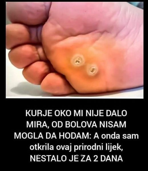 KURJE OKO MI NIJE DALO MIRA, OD BOLOVA NISAM MOGLA DA HODAM: A Onda Sam Otkrila Ovaj Prirodni Lijek, NESTALO JE ZA 2 DANA