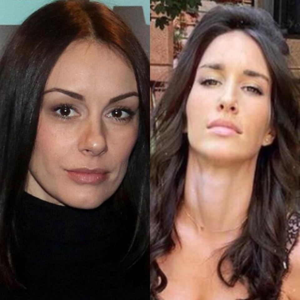 ESTETSKI HIRURG RASKRINKAO SLOBODU MIĆALOVIĆ I JELISAVETU ORAŠANIN: Otkrio spisak operacija – evo sta su sve radile